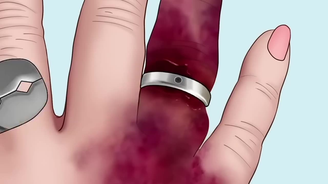 ASMR Treatment Hand So Satisfying