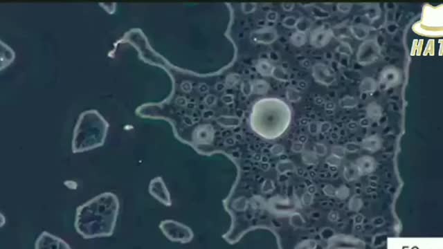 Microscopy Of The Pfizer BioNTech COVID-19 Vaccine