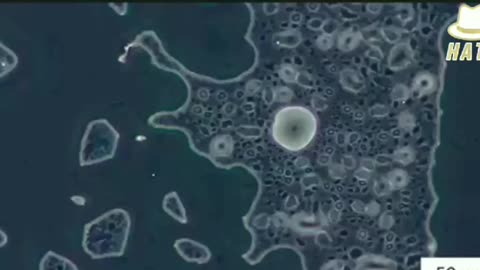 Microscopy Of The Pfizer BioNTech COVID-19 Vaccine