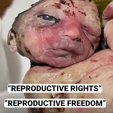 This is what "reproductive rights" look like