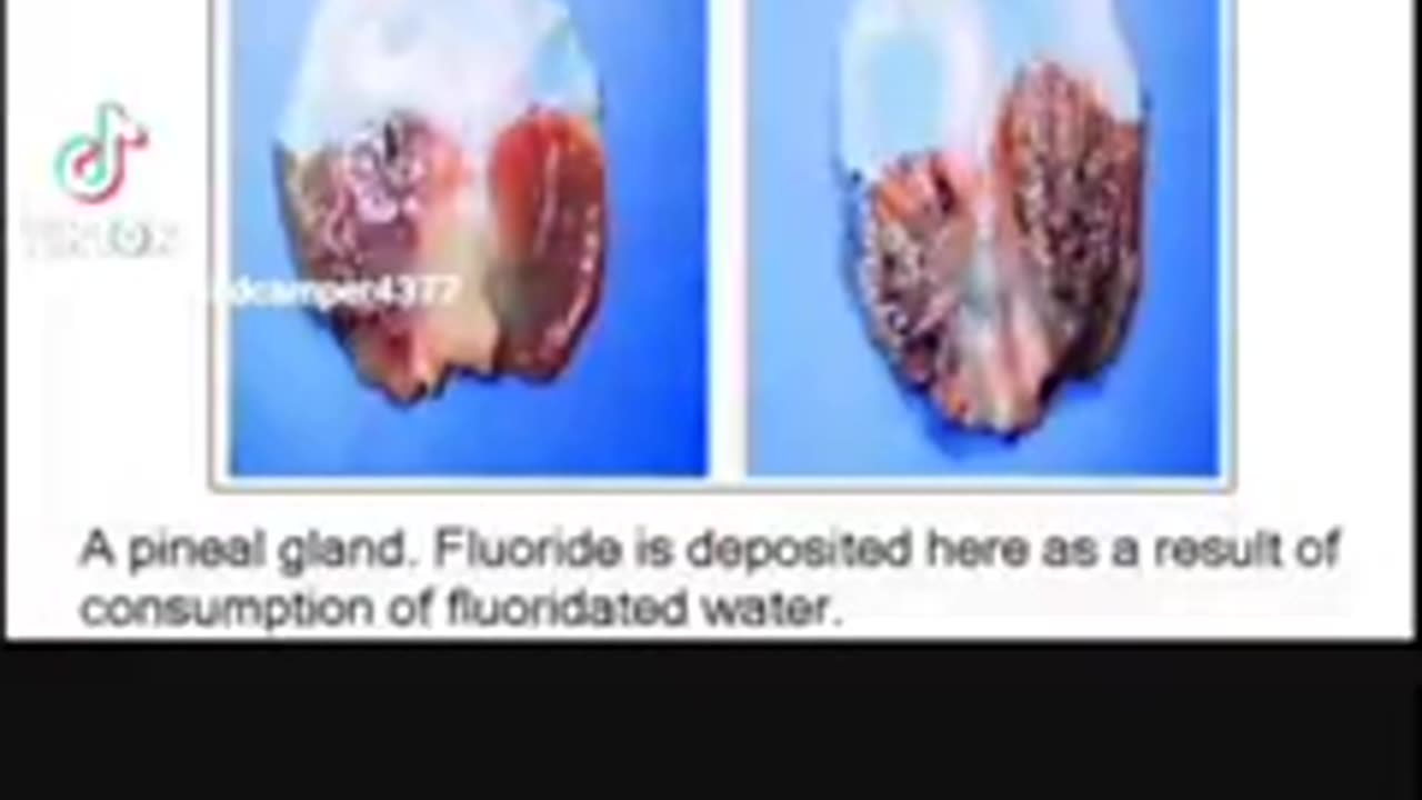 Fluoride