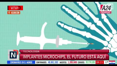 EL MICROCHIP QUE VIENE