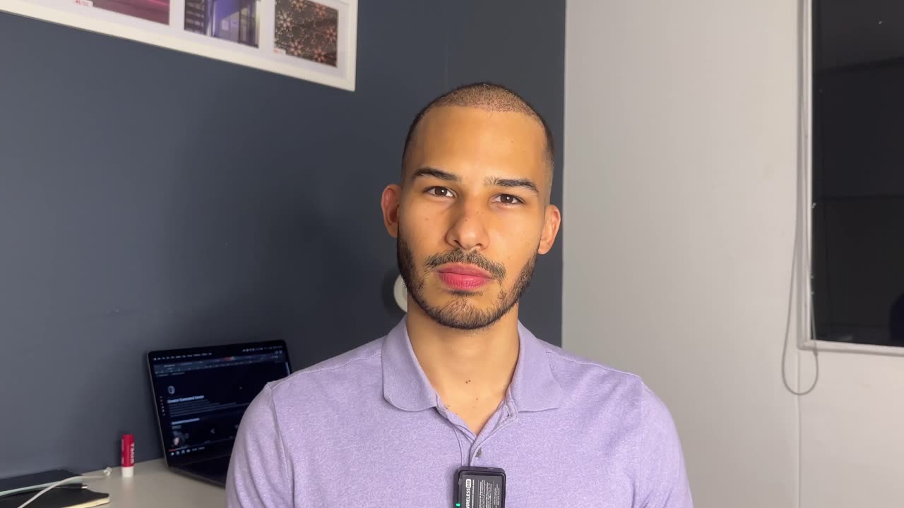 FUE Hair Transplant - 1 Month Update [Dec 3, 2023]