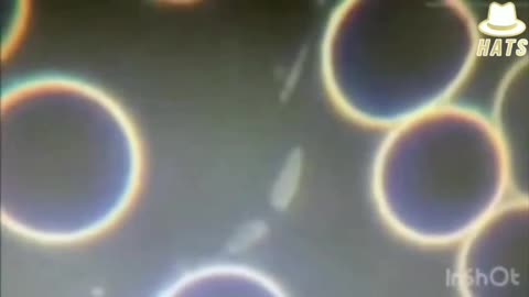 עוד גילויים ממה שנמצא בתוך החיסונים