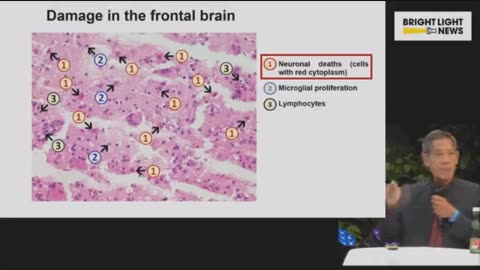 Cientista explica danos cerebrais após inoculações C-19