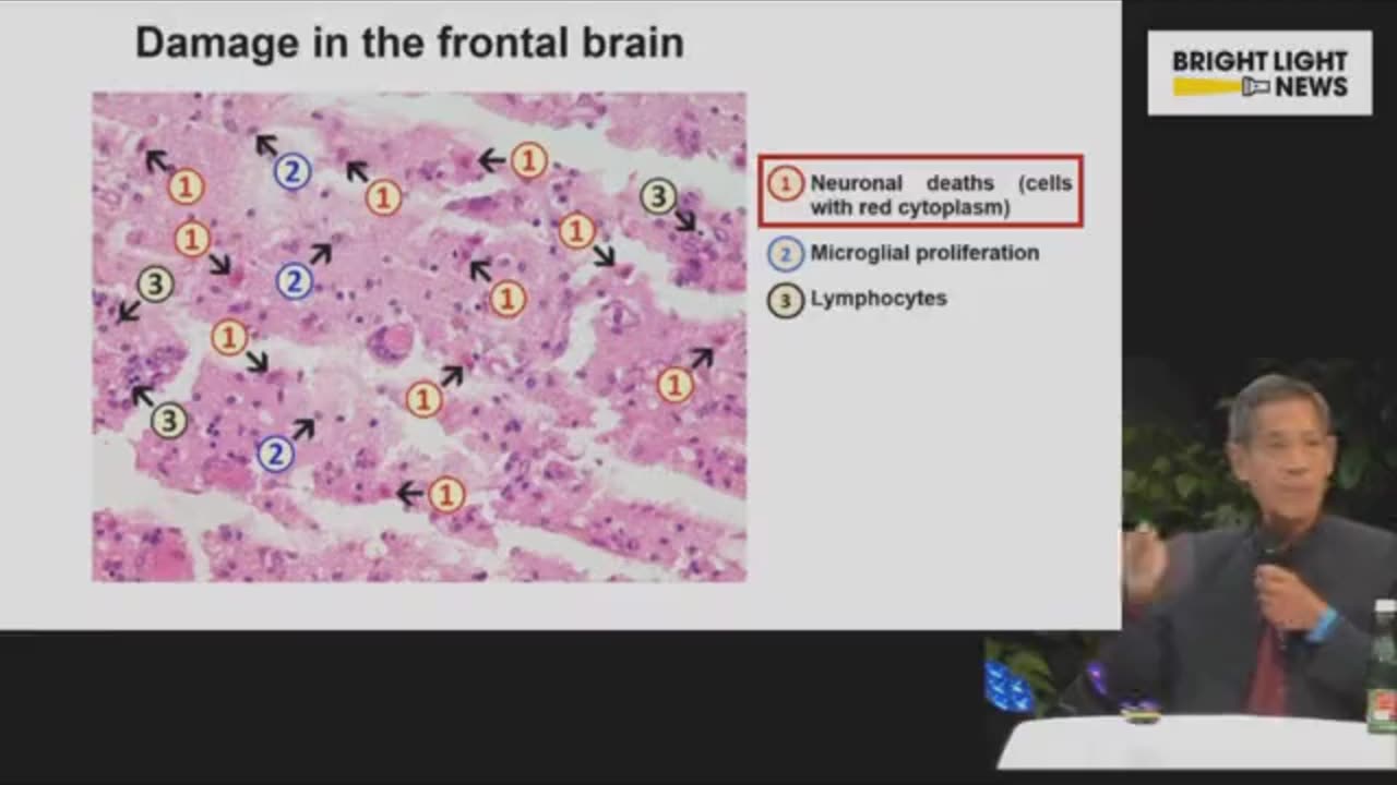 Cientista explica danos cerebrais após inoculações C-19