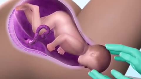 NORMAL CHILD DELIVEBE RBABY BIRTH #shorts #youtubeshorts #viral