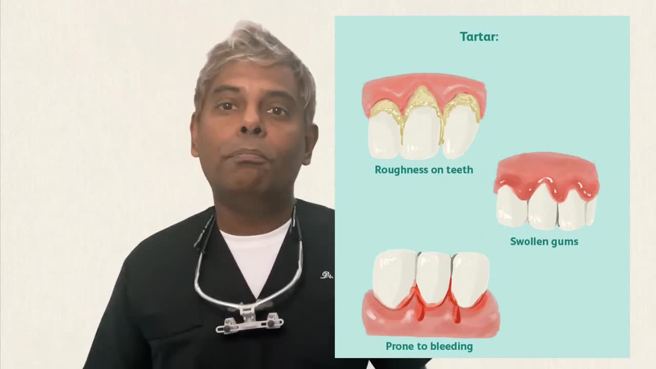 Top 3 problems with Missing Teeth and Solution to restore them!!