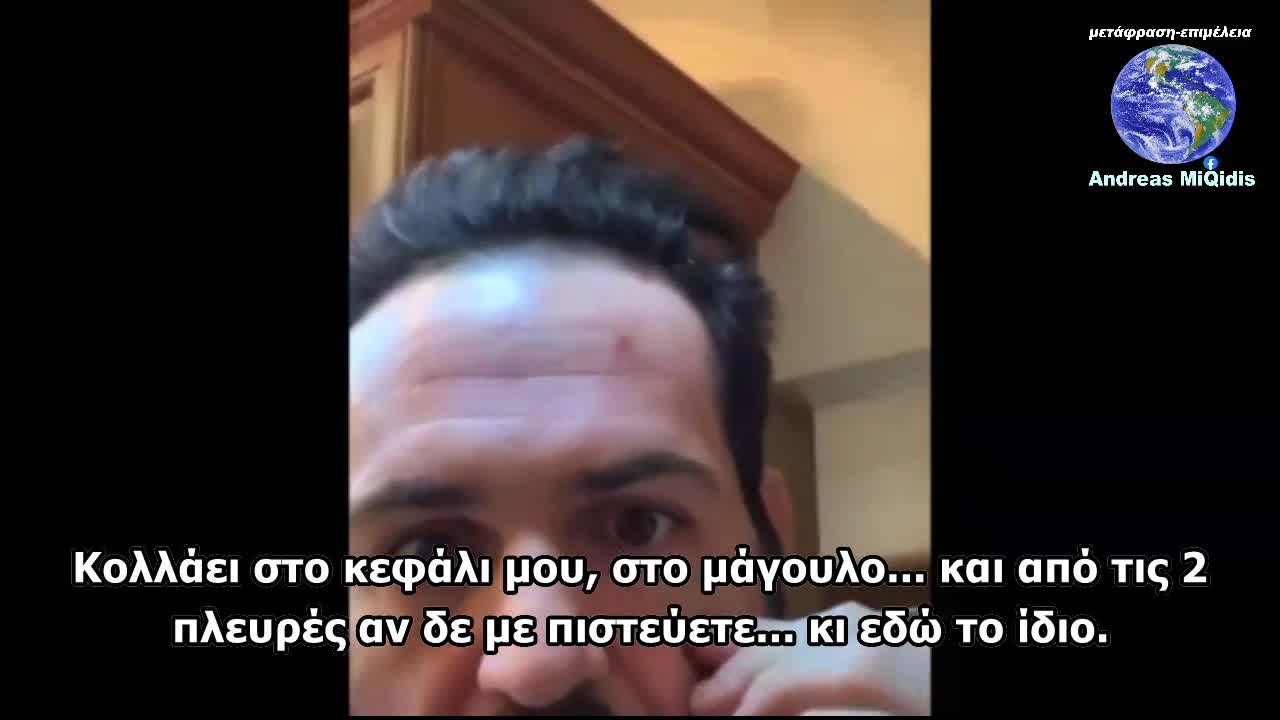 ΟΛΟ ΤΟ ΣΩΜΑ ΤΟΥ ''ΜΑΓΝΗΤΙΖΕΙ'' ΜΕΤΑ ΤΗΝ ΕΝΕΣΗ ΤΗΣ MODERNA!