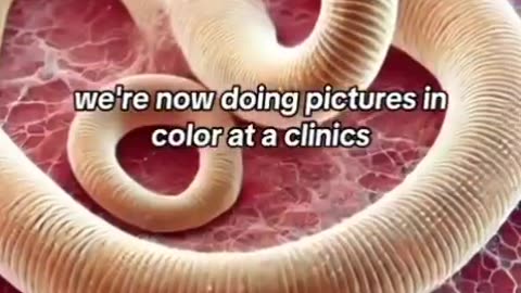 The truth about parasites…