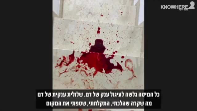 Israeli Woman Recounts her Crapcine Miscarriage