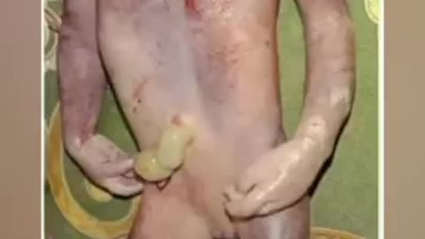 ABNORMAL BABY WITH😳 DUEL PENIS