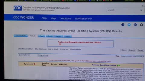 CDC Covid Vaccine deaths.