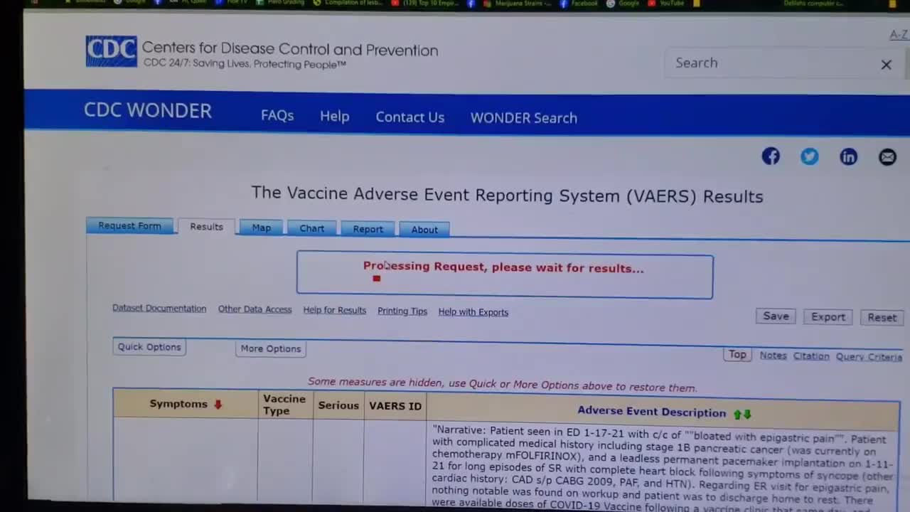 CDC Covid Vaccine deaths.