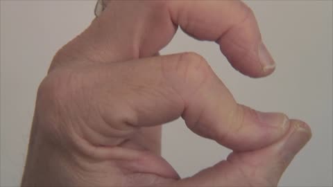 Specialty Bars Part 3: Partial Bars, Video #2: Finger Anatomy and the Partial Bar