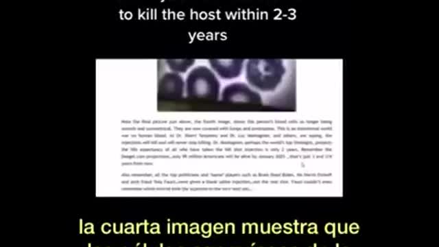 Con ciencia muestra microscopia de sangre