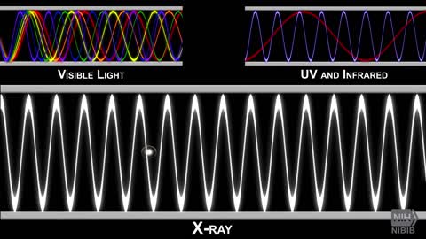 How do X-ray works