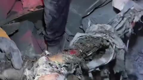 DONT LOOK AWAY - This is the Aftermath of a Massacre