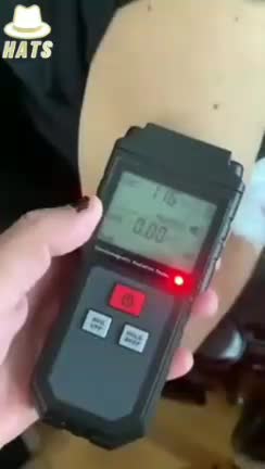 בדיקת קרינה במקום הזריקה