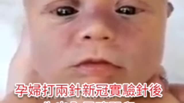 孕婦打新冠實驗毒針 生出來的孩子只有黑眼珠