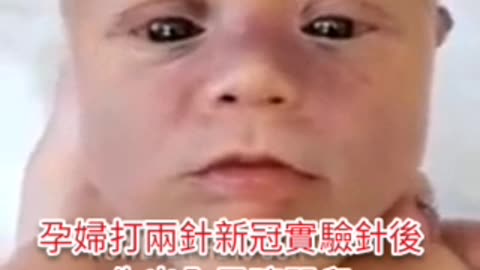 孕婦打新冠實驗毒針 生出來的孩子只有黑眼珠