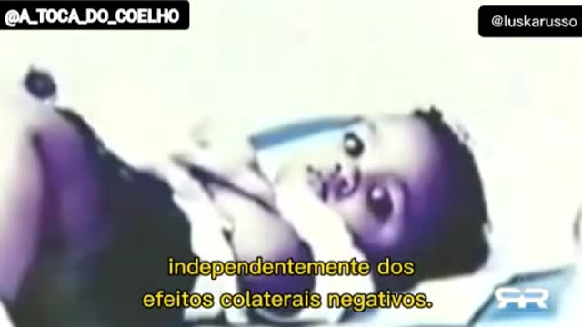 Anthony Fauci - O psicopata