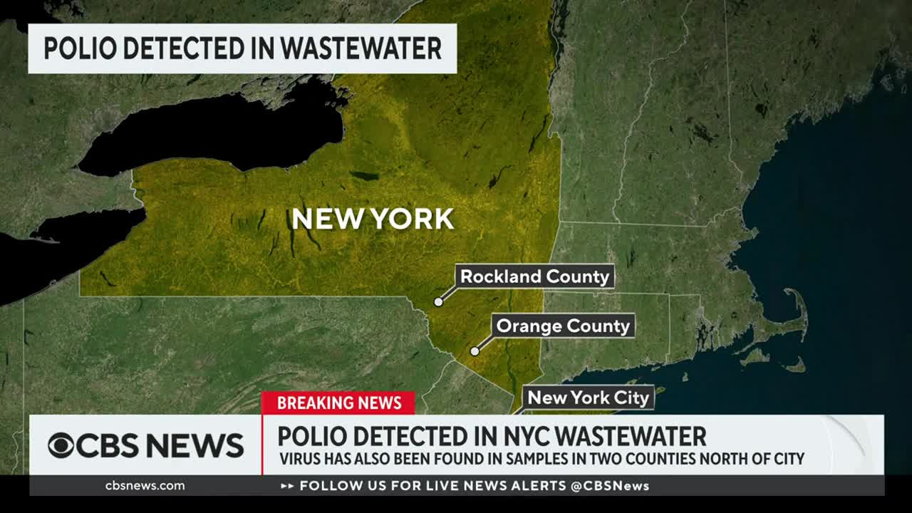 Polio detected in New York City wastewater