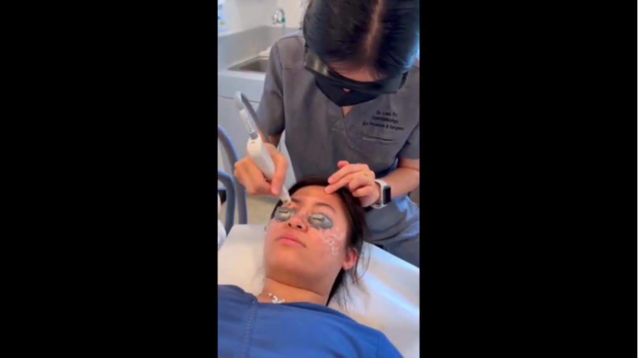 IPL for dry eye & Acne photofacial