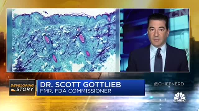 Dr. SCOTT GOTTLIEB SUGGESTS RING VACCINATION FOR MONKEYPOX