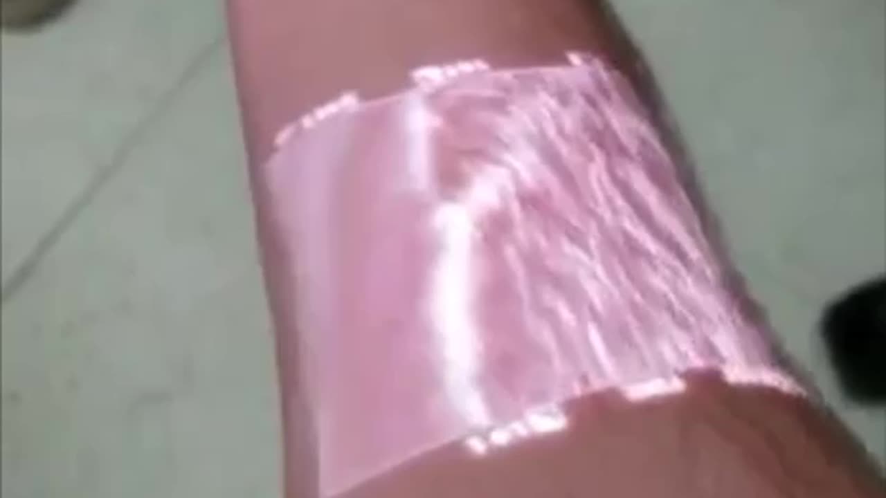 This vein visualization technology uses near-infrared light