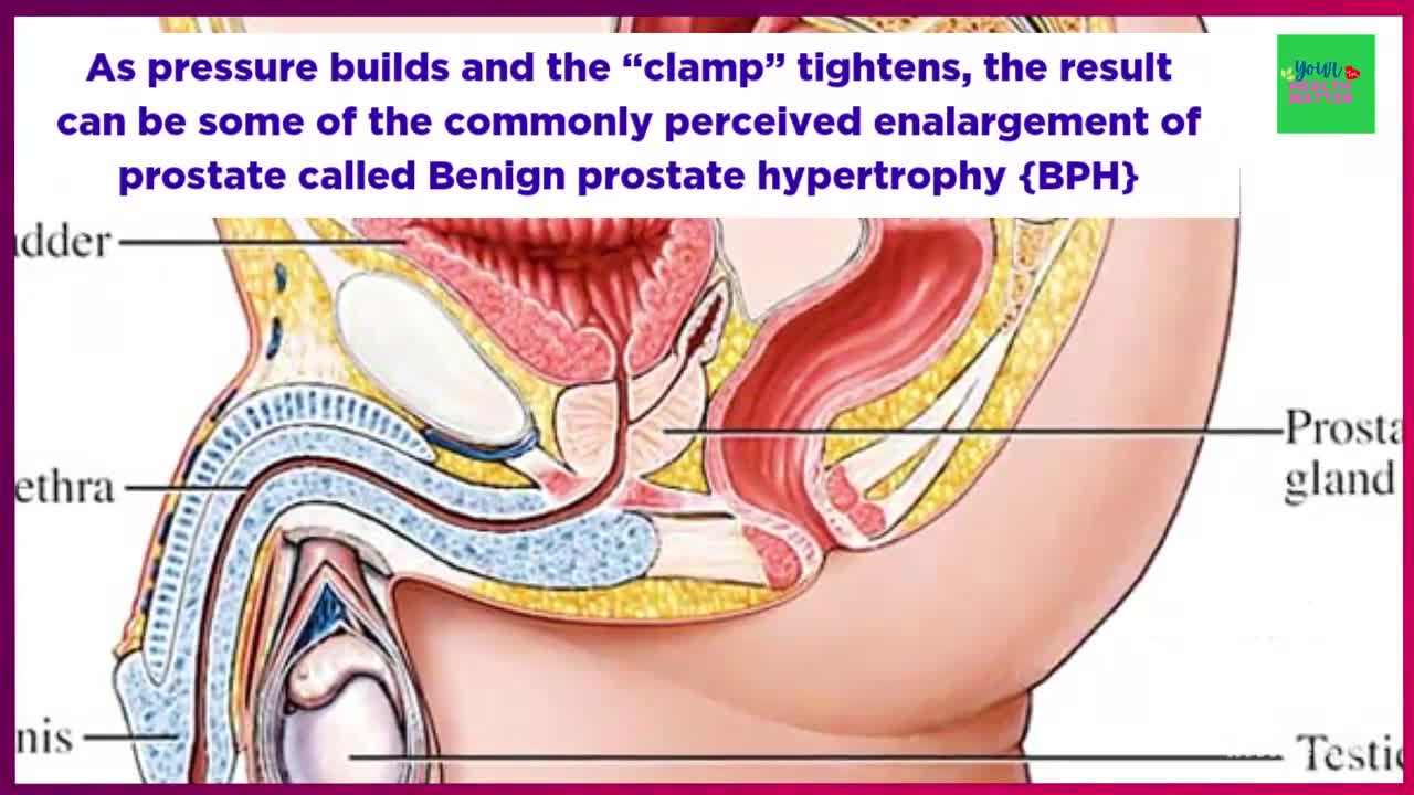 Shrink prostate Without Surgery