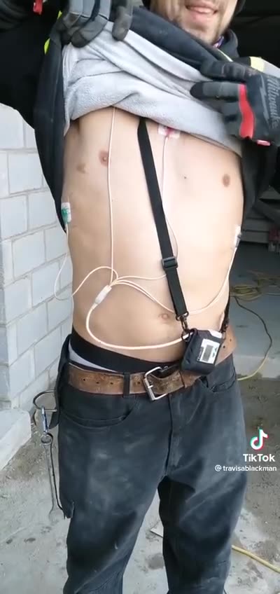 Heart injury-pericarditis-heart monitor after 3 pfizer shots_2022