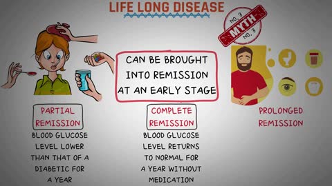 MYTHS ABOUT DIABETES | How To Lose Diabetes Fast
