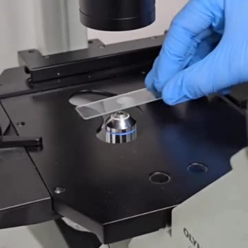 Turmeric vs Parasites