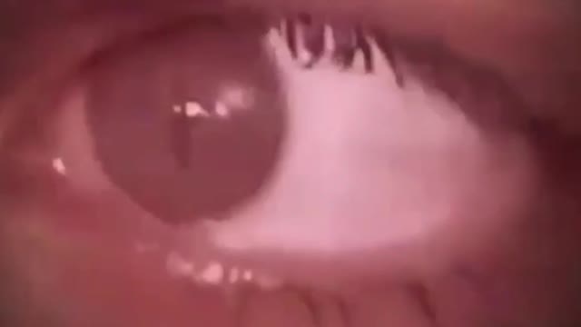 Reptilian eyes