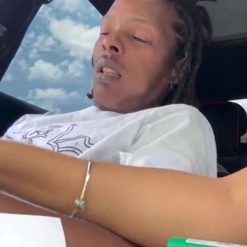 I wonder what dentist he went to.. cause he doped out his mind 😫 look like they gave bro