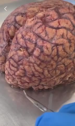 Crazy!!! Clip of the human brain.