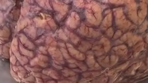 Crazy!!! Clip of the human brain.