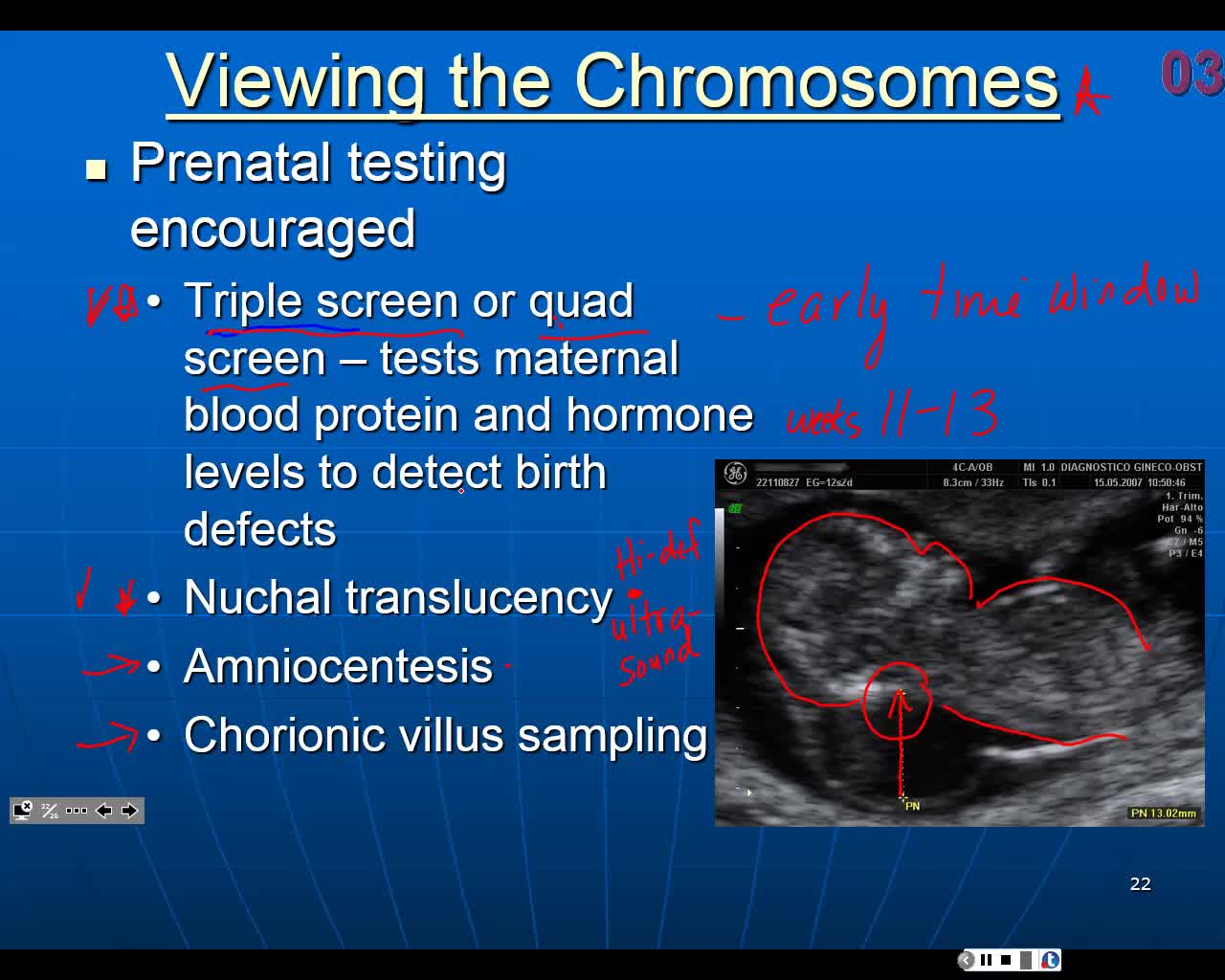 Prenatal Testing for Genetic Disorders