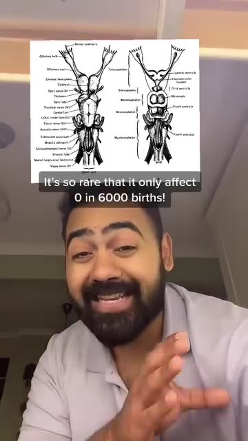 Fascinating thing about world rare genetic mutation