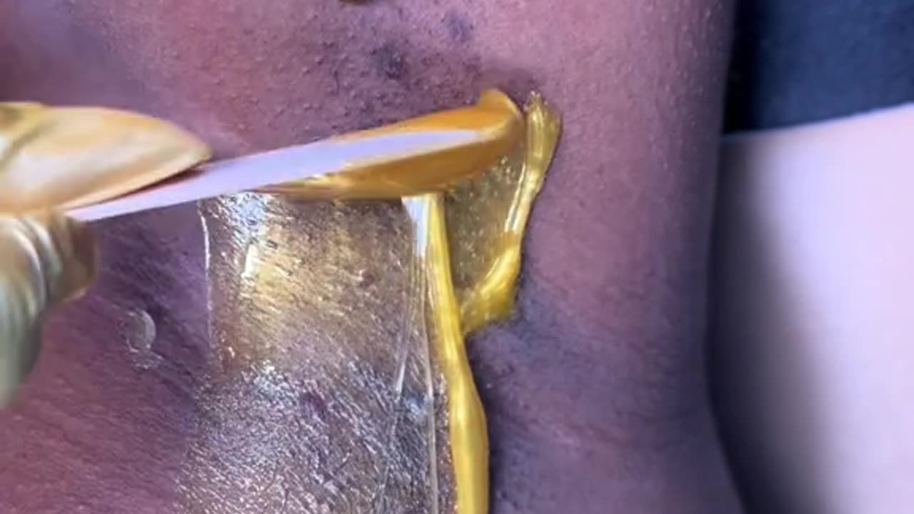 Underarm Waxing with Sexy Smooth Golden Allure Hard Wax | @aureateaesthetics_