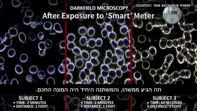 האמת אודות קרינה ודילול אוכלוסין