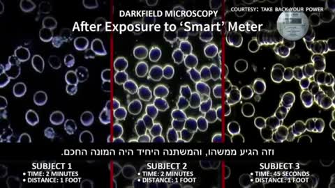 האמת אודות קרינה ודילול אוכלוסין