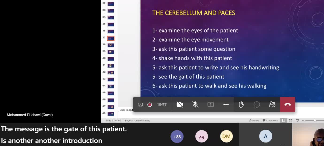 ST3.Cerebellar syndromes Lahawi