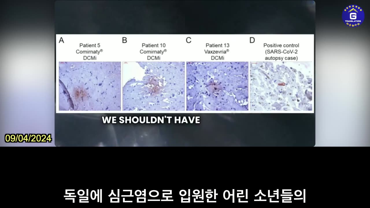 【KR】맥컬러프 박사: 많은 연구에서 코로나19 백신이 심장에 손상을 입힌다는 사실이 밝혀짐.