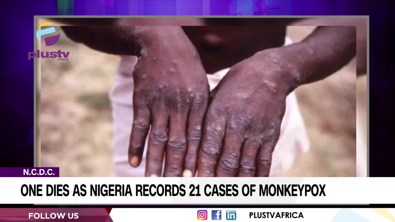 N.C.D.C.: One Dies As Nigeria Records 21 Cases Of Monkeypox | NEWS