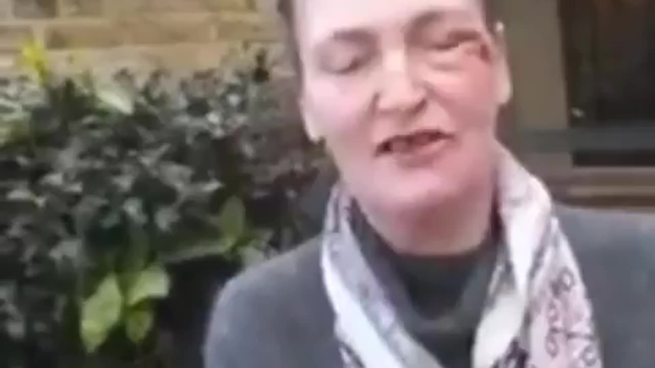 This poor lady has been attacked in an attempted mugging in London.