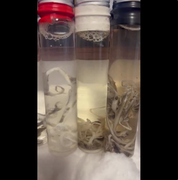 White Rubber Clots in Bodies of Deceased Vaccinated Victims