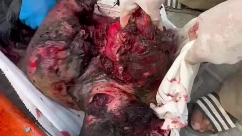Situation in Gaza