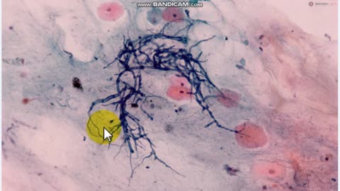 Mirror|GOVERMENT ADMITS MORGELLONS ANTENNA - AND A LOT MORE